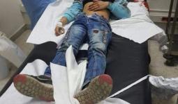 إصابة طفلة في حادثة إطلاق نار بمخيّم البدّاوي