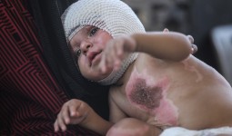 طفل فلسطيني جريح في قطاع غزة