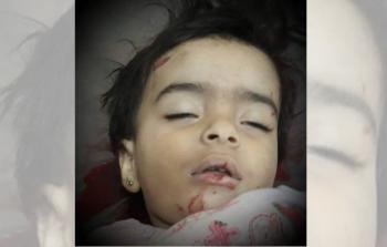 الطفلة اسراء شهيدة الحصار على مخيم خان الشيح