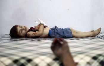 طفل استشهد جراء الغارات الروسية على مدينة حلب