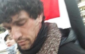 إصابة ناشط عقب اعتداء الشرطة اليونانية على اعتصام أمام سفارة الاحتلال