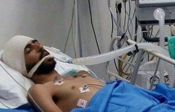 استشهاد فلسطيني من القدس المحتلة متأثراً بجراحه