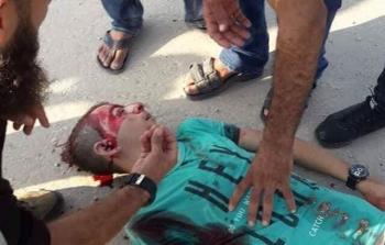 شهيدان وإصابات جراء عدوان الاحتلال على غزة