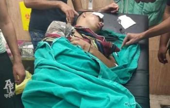 أحد الشبان المصابين من مخيّم بلاطة خلال المواجهات التي اندلعت عقب اقتحام مدينة نابلس