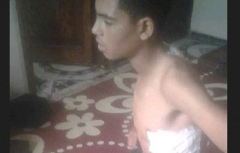 الفتى محمد شادي بعد تعرضه للطعن