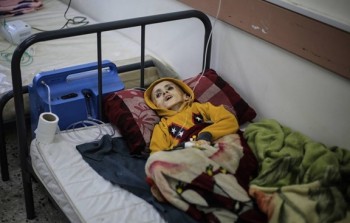 الطفل يزن كفارنة الذي ارتقى بسبب حصار الاحتلال في مدينة رفح (د.ب.أ)