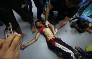 طفل مصاب وصل إلى مستشفى شهداء الأقصى جراء القصف 