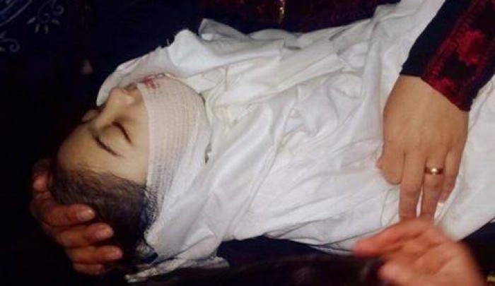 الطفلة منى عثمان .. آخر ضحايا الخذلان الصحي لفلسطينيي لبنان 