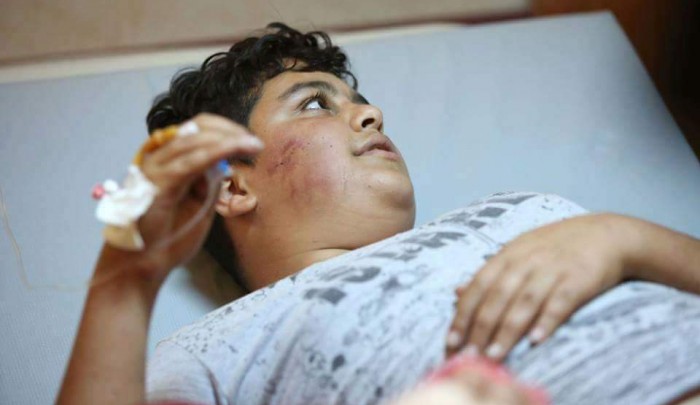الفتى أسامة دغلس الذي تعرض لاعتداء من قبل مستوطنين