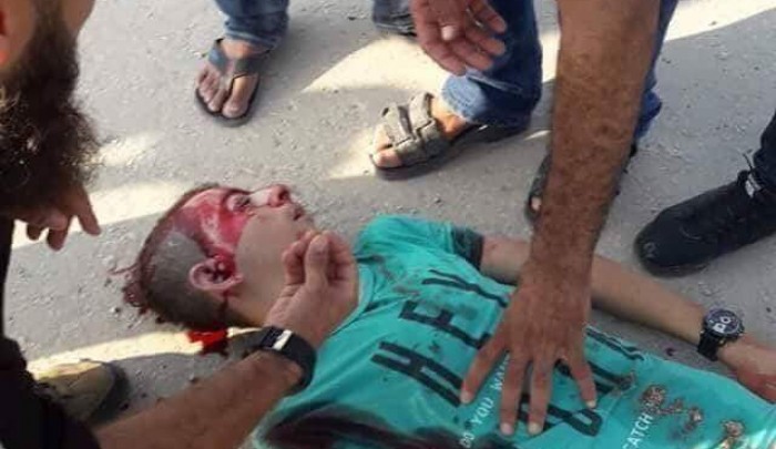 شهيدان وإصابات جراء عدوان الاحتلال على غزة