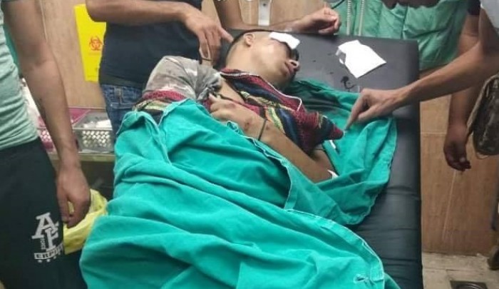 أحد الشبان المصابين من مخيّم بلاطة خلال المواجهات التي اندلعت عقب اقتحام مدينة نابلس