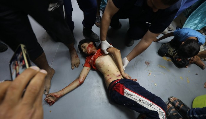طفل مصاب وصل إلى مستشفى شهداء الأقصى جراء القصف "الإسرائيلي" على وسط قطاع غزة (APA)