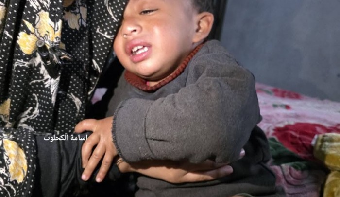 الطفل كريم أبو نصار يبكي آلام التعذيب